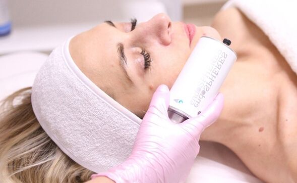 Terapija kože obraza z endosfero za pomlajevalni učinek
