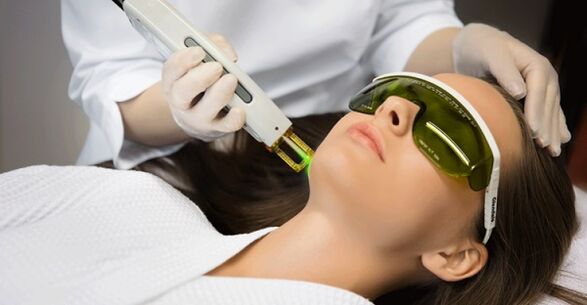 Neablativni laserski postopek pomlajevanja kože