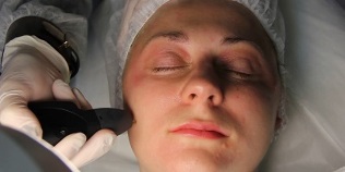 kako se pripraviti na postopek pomlajevanja kože v plazmi
